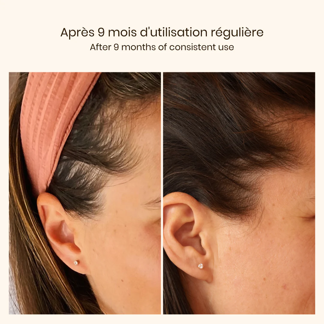 Densifying Hair Serum with peptides and maca root extract - Image 4